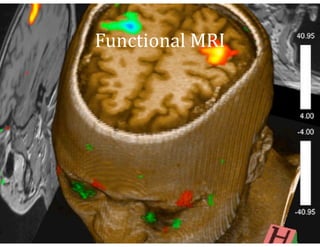 Functional	
  MRI




Grid Overview - Ian Stokes-Rees        ijstokes@seas.harvard.edu
 