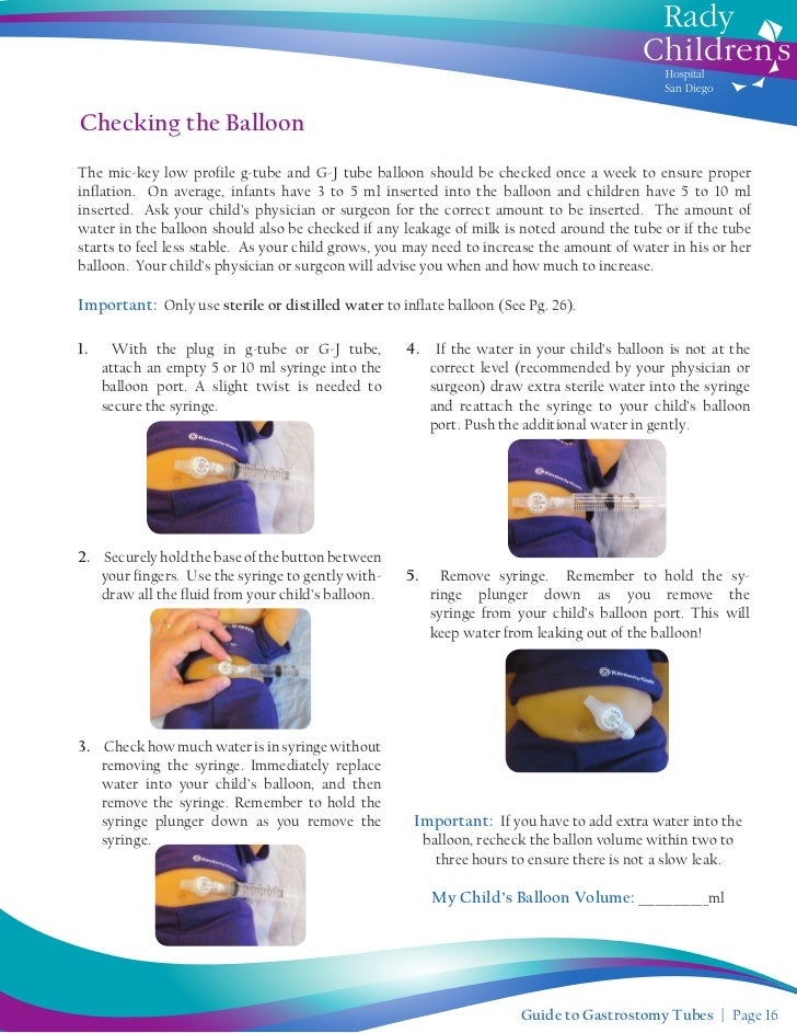 How to reinsert a gastric tube