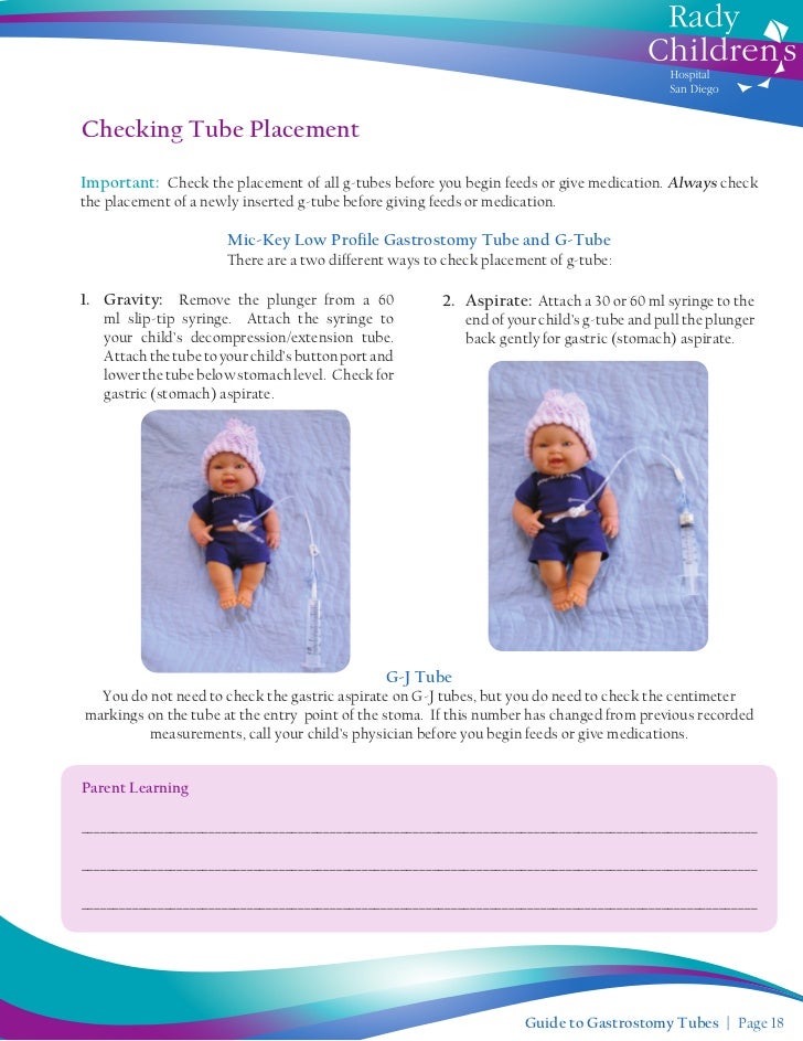 Guide to Gastrostomy Tubes