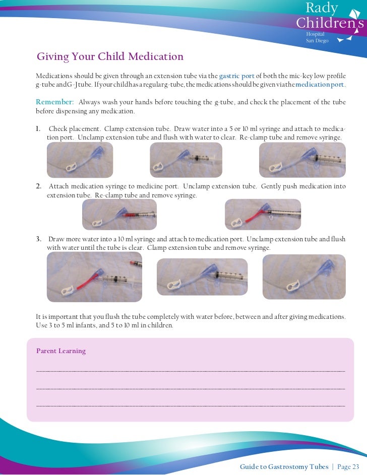 Guide To Gastrostomy Tubes Guide To Gastrostomy Tubes
