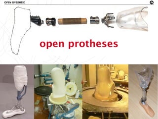 OPEN OVERHEID




                open protheses
 