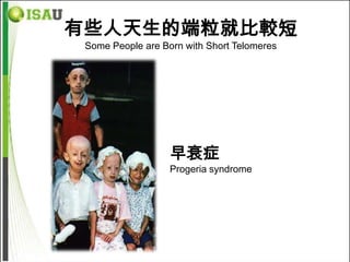 有些人天生的端粒就比較短
 Some People are Born with Short Telomeres




                   早衰症
                   Progeria syndrome
 