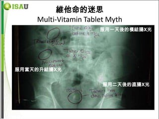維他命的迷思
    Multi-Vitamin Tablet Myth
                      服用一天後的橫結腸X光




服用當天的升結腸X光


                       服用二天後的直腸X光
 