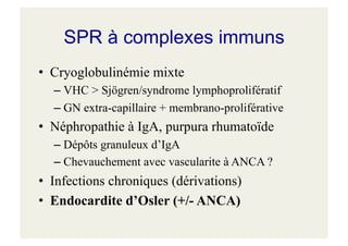 SPR à complexes immuns
• Cryoglobulinémie mixte
– VHC > Sjögren/syndrome lymphoprolifératif
– GN extra-capillaire + membrano-proliférative
• Néphropathie à IgA, purpura rhumatoïde
– Dépôts granuleux d’IgA
– Chevauchement avec vascularite à ANCA ?
• Infections chroniques (dérivations)
• Endocardite d’Osler (+/- ANCA)
 