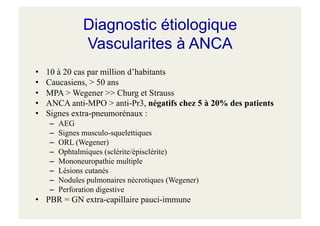 Diagnostic étiologique
Vascularites à ANCA
• 10 à 20 cas par million d’habitants
• Caucasiens, > 50 ans
• MPA > Wegener >> Churg et Strauss
• ANCA anti-MPO > anti-Pr3, négatifs chez 5 à 20% des patients
• Signes extra-pneumorénaux :
– AEG
– Signes musculo-squelettiques
– ORL (Wegener)
– Ophtalmiques (sclérite/épisclérite)
– Mononeuropathie multiple
– Lésions cutanés
– Nodules pulmonaires nécrotiques (Wegener)
– Perforation digestive
• PBR = GN extra-capillaire pauci-immune
 