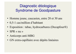 Diagnostic étiologique
Syndrome de Goodpasture
• Homme jeune, caucasien, entre 20 et 30 ans
• 0,5-1 cas/million d’habitant
• Exposition : tabac, hydrocarbures (Decapfour®)
• SPR « nu »
• Anticorps anti-MBG
• GN extra-capillaire avec dépôts linéaires
 
