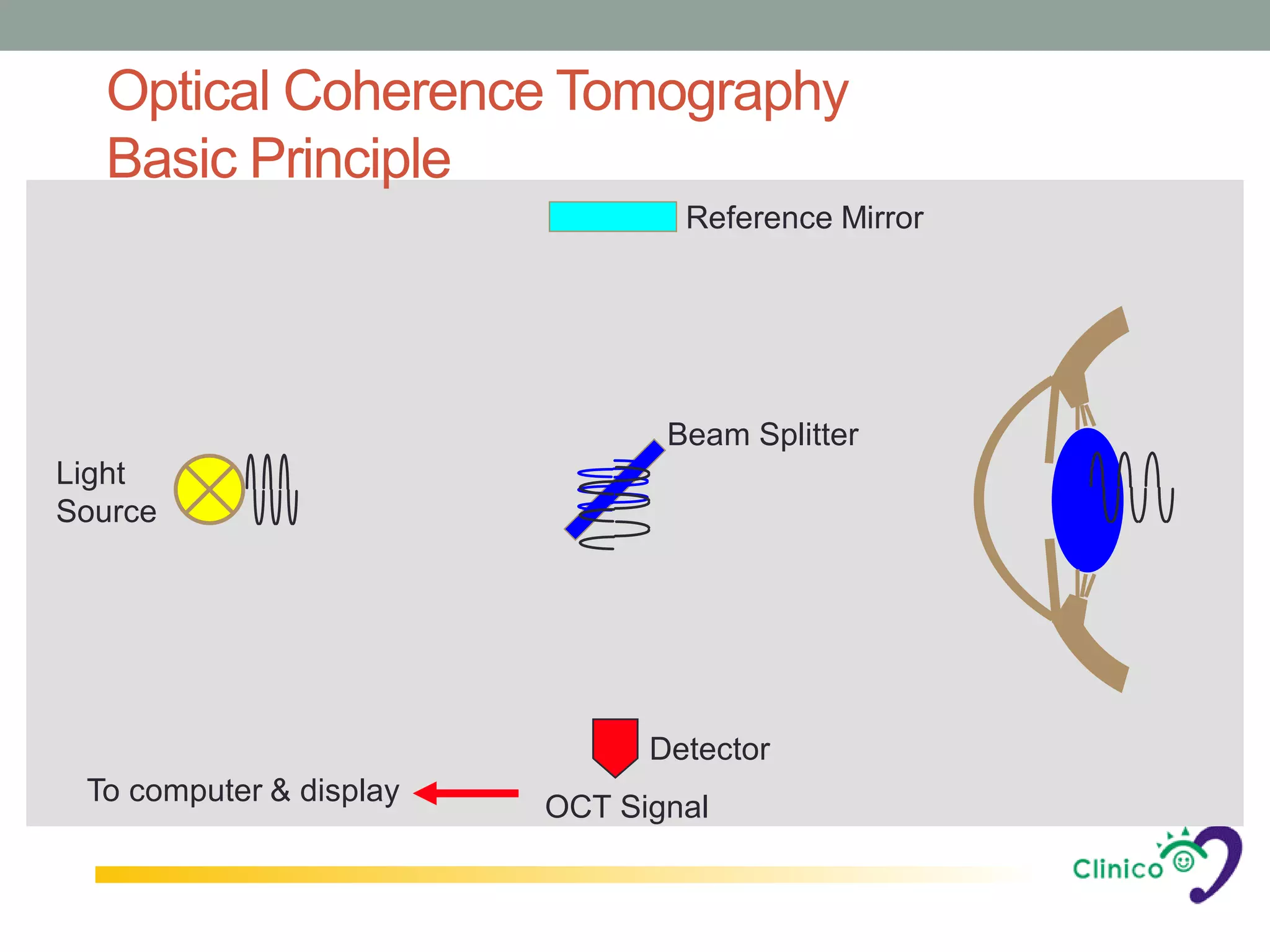 Optical Coherence Tomography
  Basic Principle
                                 Reference Mirror




                                Beam Splitter
Light
Source




                               Detector
 To computer & display
                         OCT Signal
 