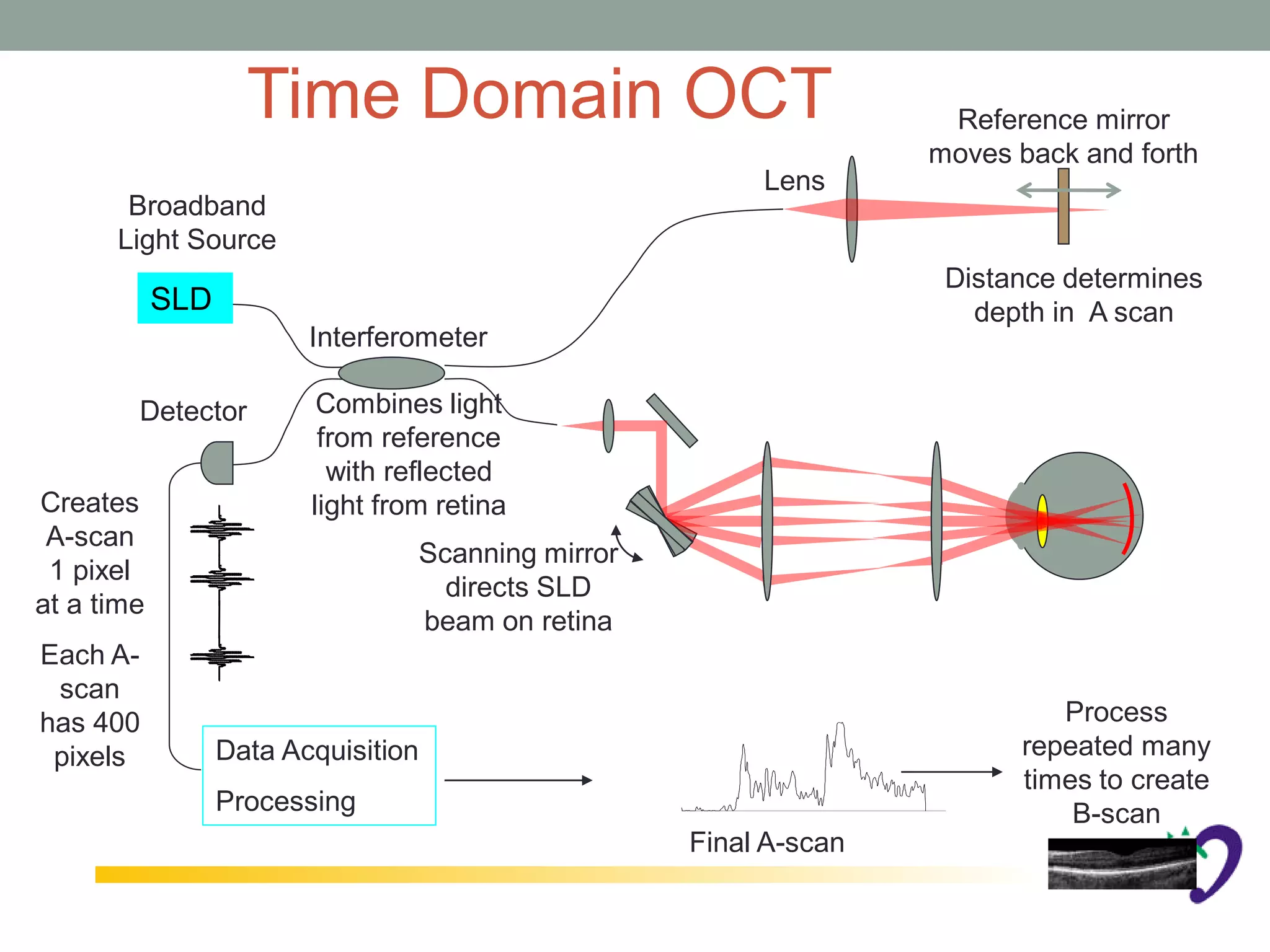 Time Domain OCT                                 Reference mirror
                                                                   moves back and forth
                                                         Lens
       Broadband
      Light Source
                                                                    Distance determines
            SLD                                                       depth in A scan
                         Interferometer

        Detector          Combines light
                          from reference
                           with reflected
Creates                  light from retina
 A-scan
                                  Scanning mirror
 1 pixel
                                    directs SLD
at a time
                                  beam on retina
Each A-
 scan
has 400                                                                     Process
 pixels           Data Acquisition                                       repeated many
                                                                         times to create
                  Processing                                                 B-scan
                                                    Final A-scan
 