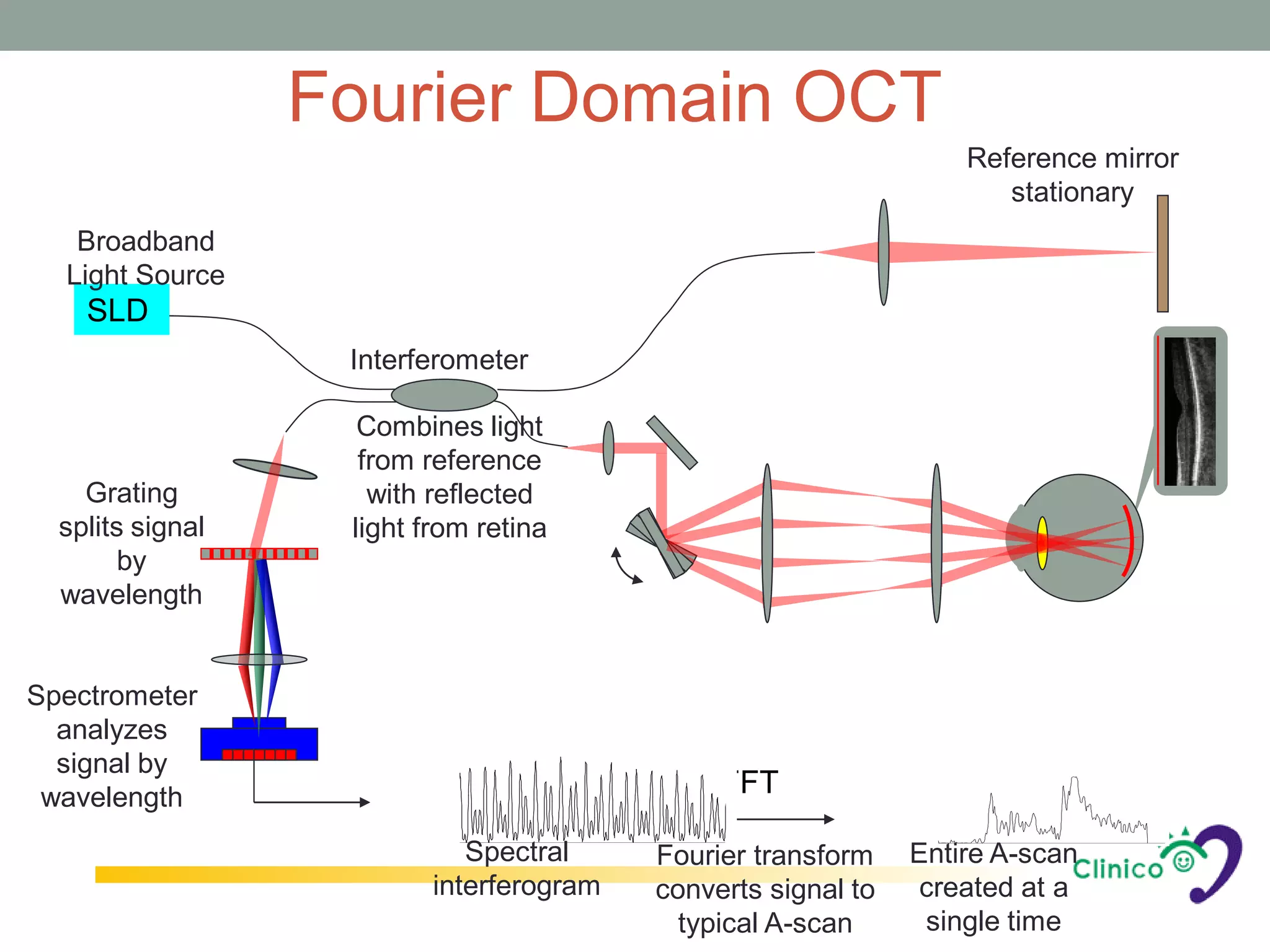 Fourier Domain OCT
                                                                   Reference mirror
                                                                      stationary
   Broadband
  Light Source
    SLD
                   Interferometer

                    Combines light
                    from reference
    Grating          with reflected
  splits signal    light from retina
        by
  wavelength


Spectrometer
  analyzes
  signal by
 wavelength                                    FFT

                             Spectral     Fourier transform    Entire A-scan
                          interferogram   converts signal to    created at a
                                            typical A-scan      single time
 