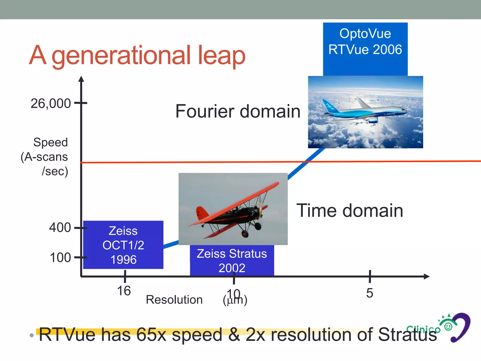 OptoVue
                                                RTVue 2006
 A generational leap
 26,000
                          Fourier domain
  Speed
(A-scans
    /sec)


                                             Time domain
     400     Zeiss
            OCT1/2
     100                     Zeiss Stratus
             1996
                                 2002
              16                   10                5
                     Resolution   (µm)


 • RTVue has 65x speed & 2x resolution of Stratus
 