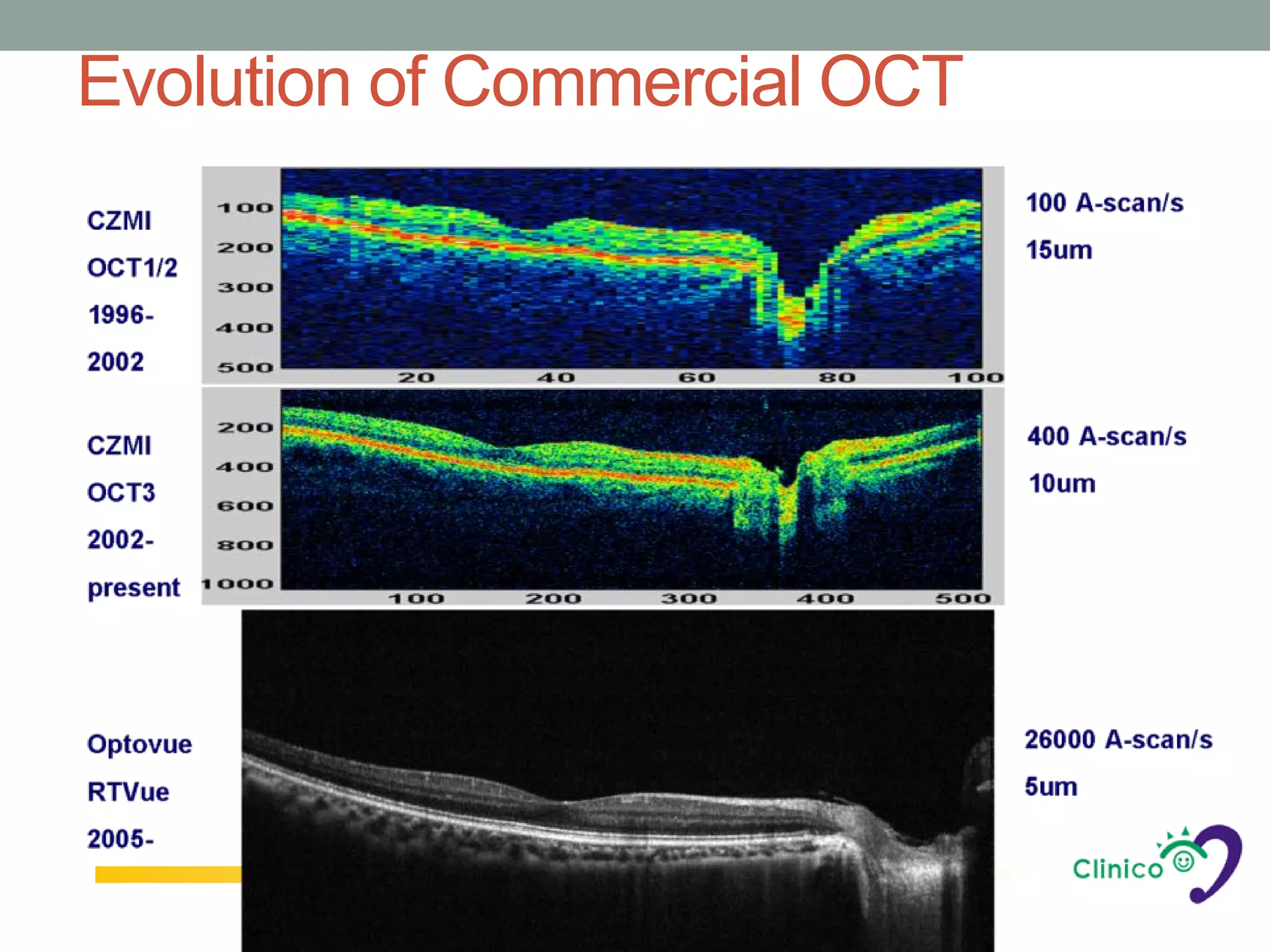 Evolution of Commercial OCT
 