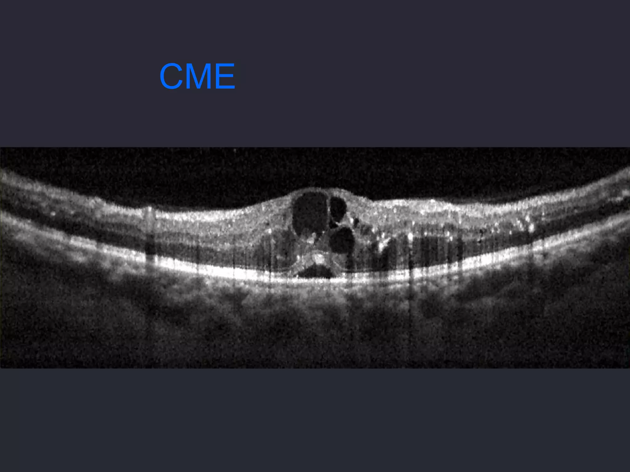 CME
 