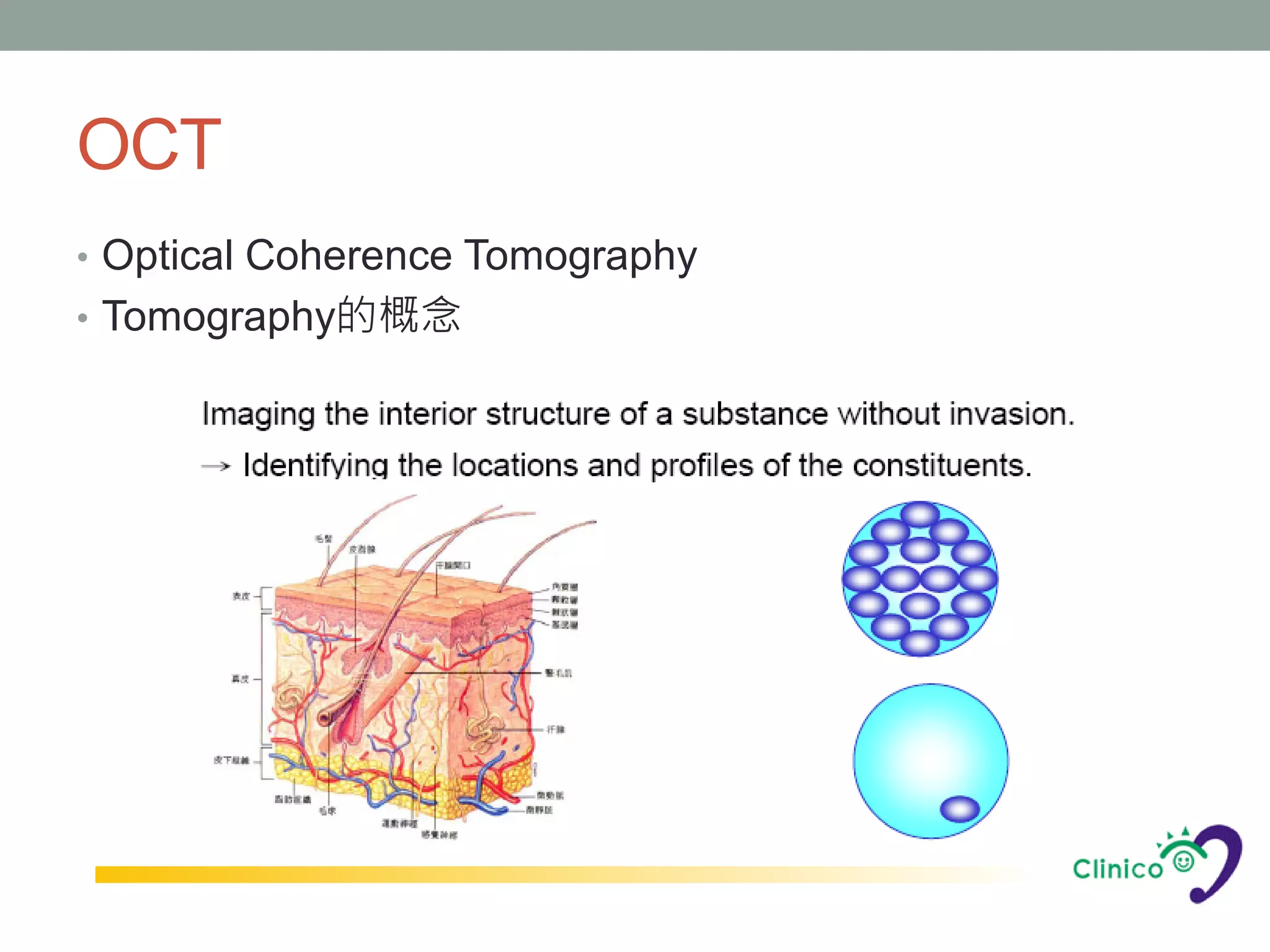 OCT
• Optical Coherence Tomography
• Tomography的概念
 