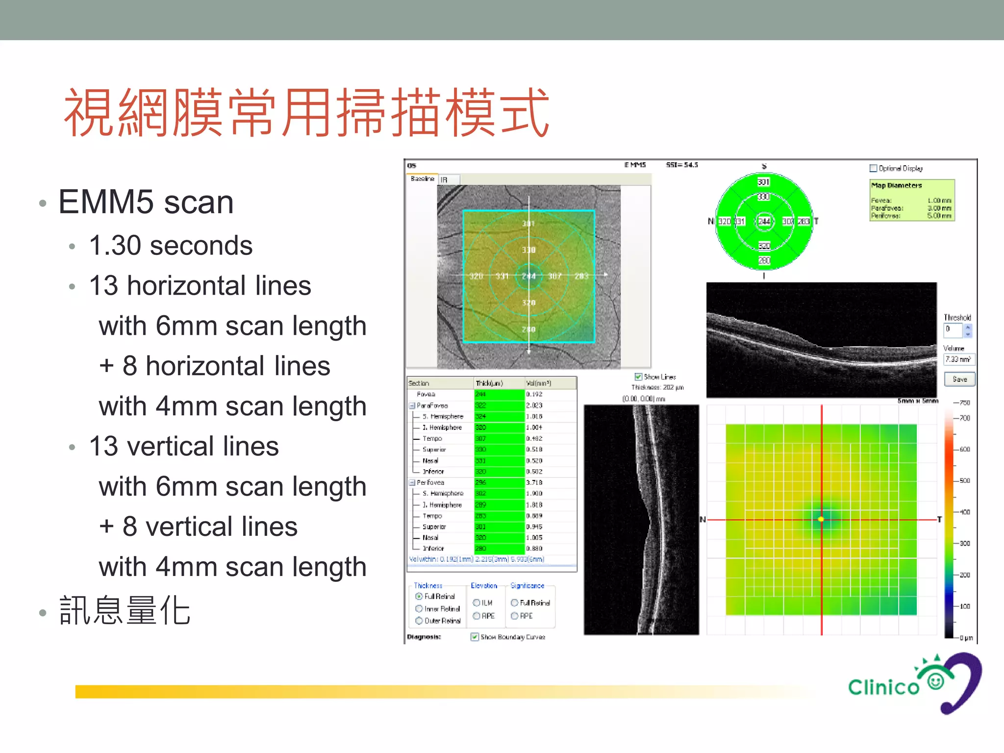 視網膜常用掃描模式
• EMM5 scan
  • 1.30 seconds
  • 13 horizontal lines
     with 6mm scan length
     + 8 horizontal lines
     with 4mm scan length
  • 13 vertical lines
     with 6mm scan length
     + 8 vertical lines
     with 4mm scan length
• 訊息量化
 