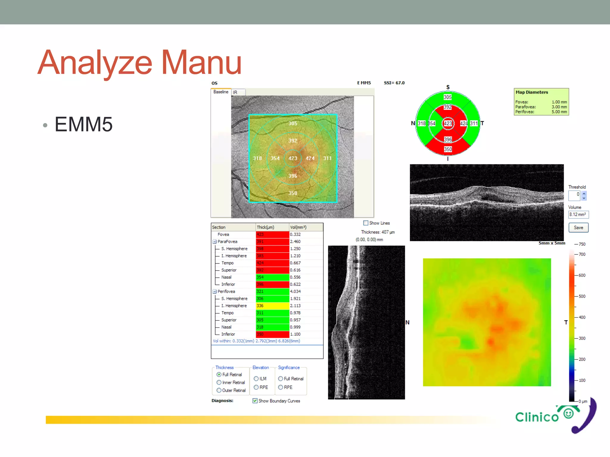 Analyze Manu
• EMM5
 