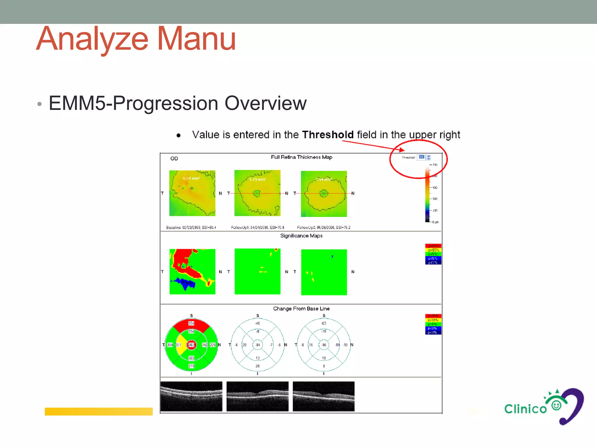 Analyze Manu
• EMM5-Progression Overview
 
