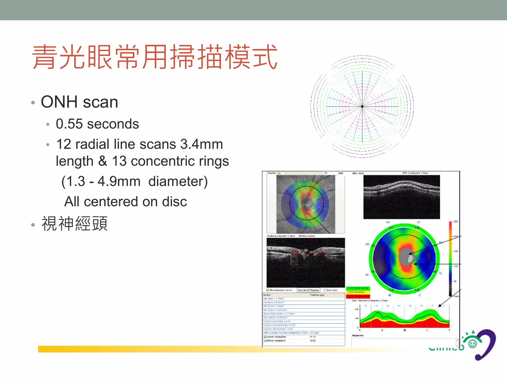 青光眼常用掃描模式
• ONH scan
  • 0.55 seconds
  • 12 radial line scans 3.4mm
    length & 13 concentric rings
     (1.3 - 4.9mm diameter)
      All centered on disc
• 視神經頭
 