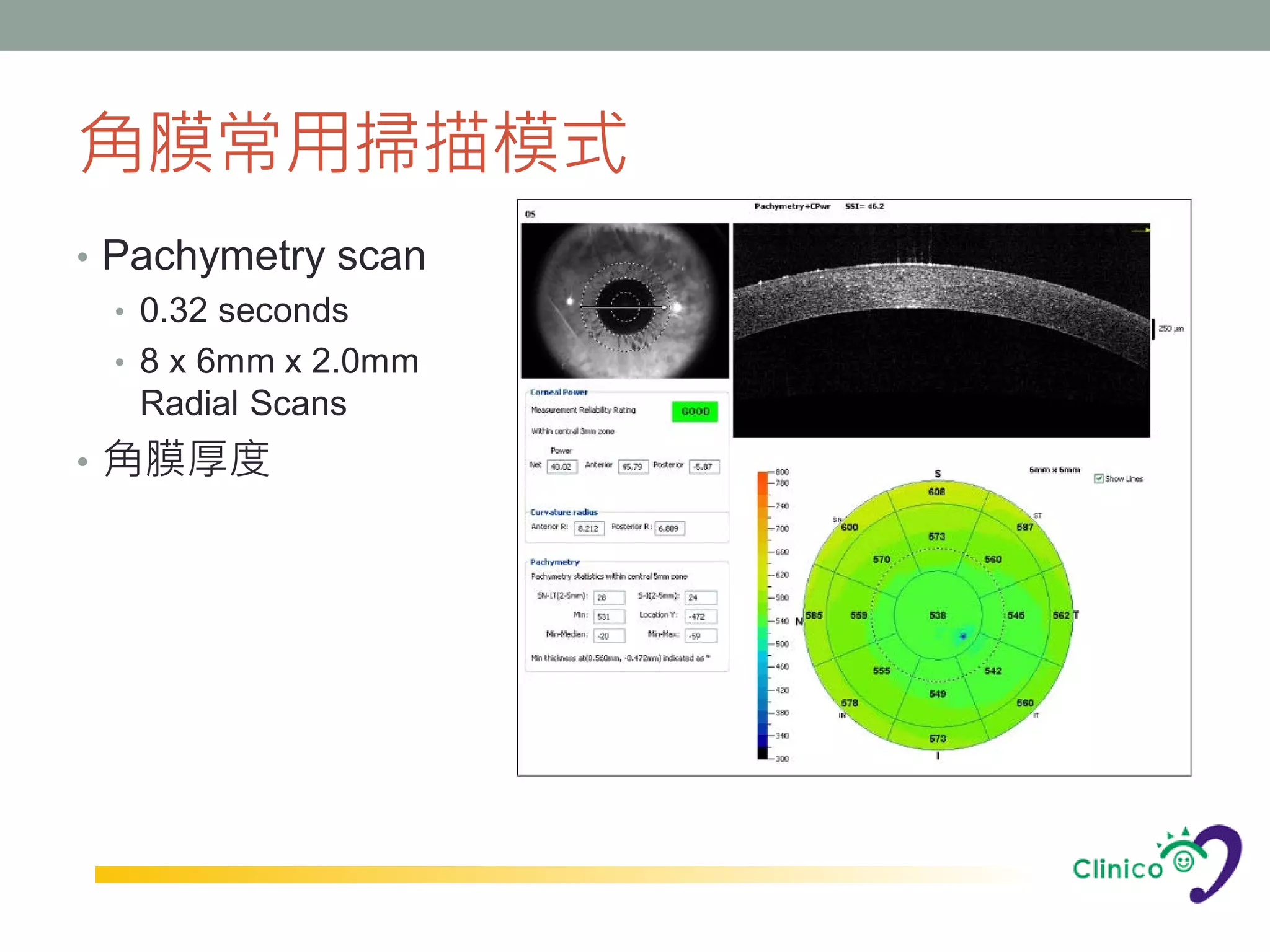 角膜常用掃描模式
• Pachymetry scan
  • 0.32 seconds
  • 8 x 6mm x 2.0mm
    Radial Scans
• 角膜厚度
 