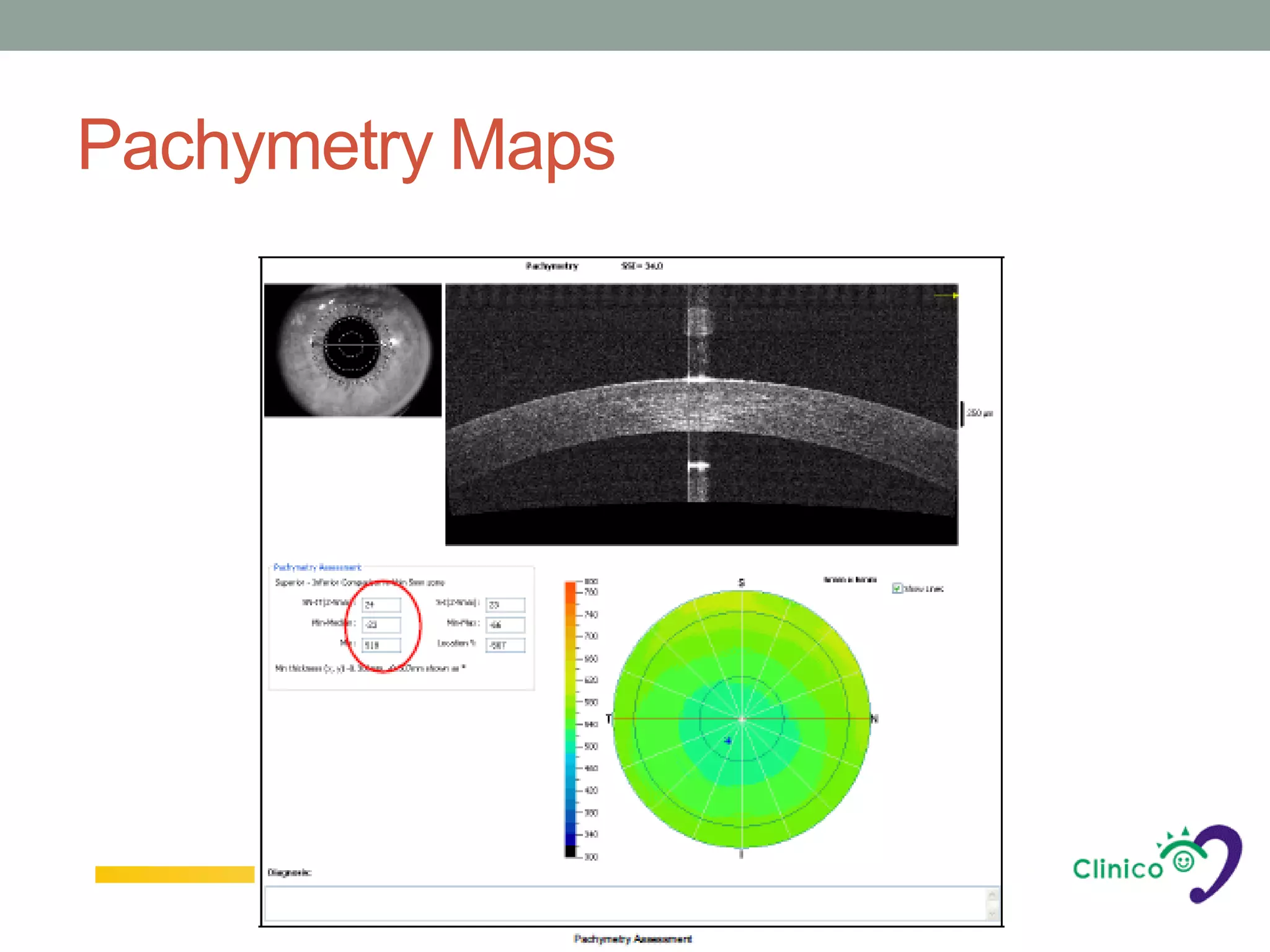 Pachymetry Maps
 