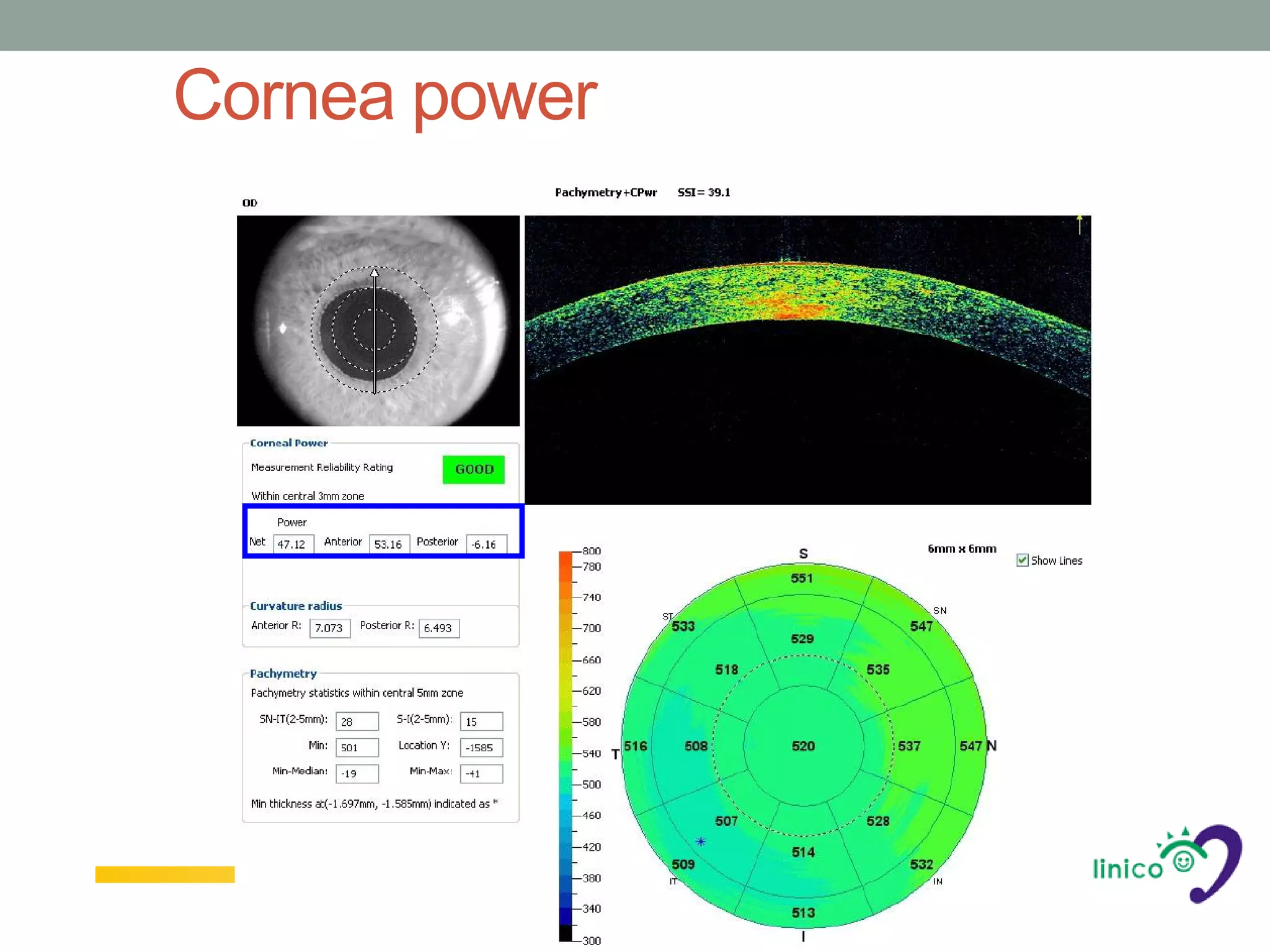 Cornea power
 