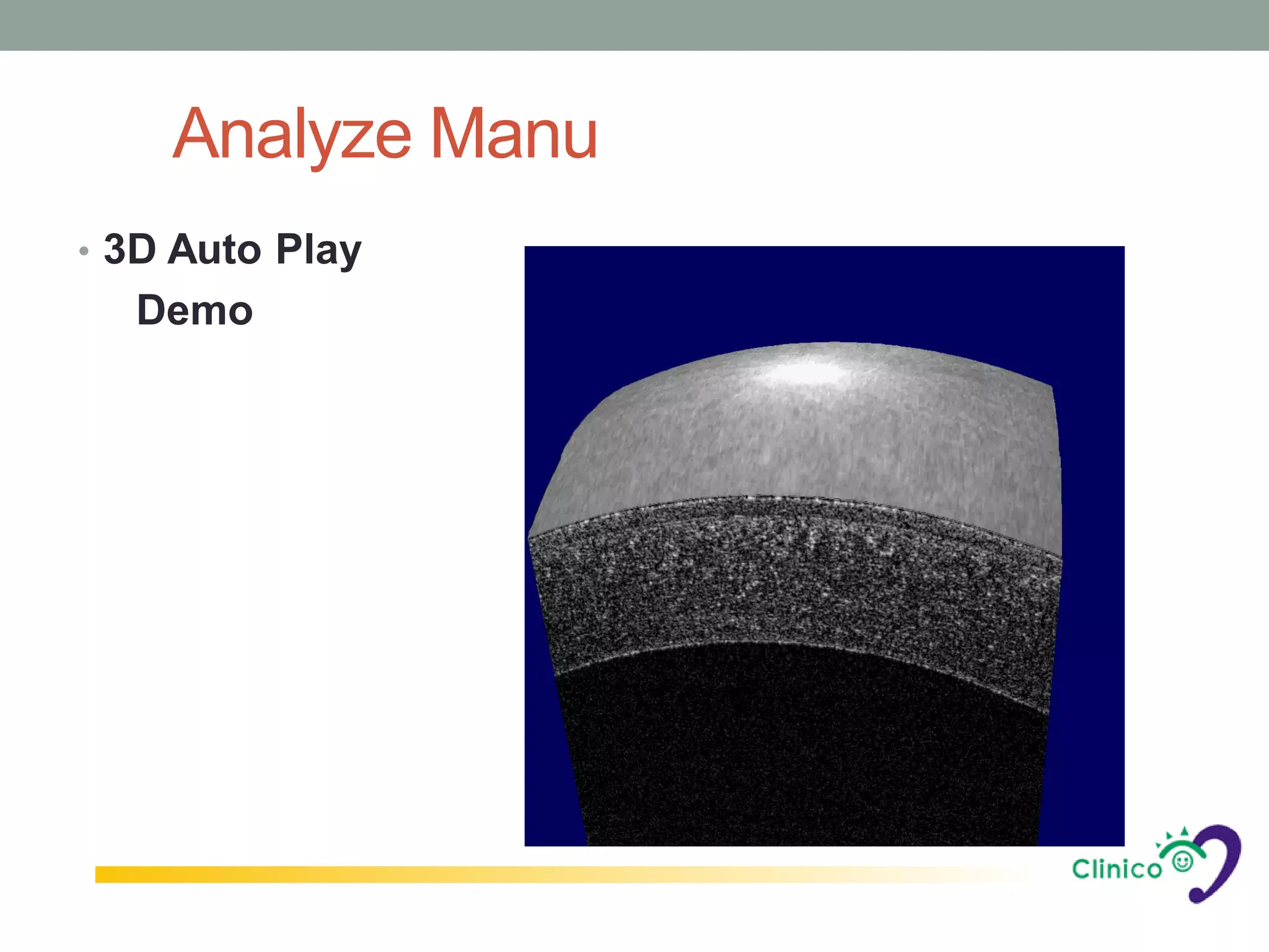 Analyze Manu
• 3D Auto Play
  Demo
 