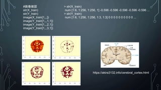 #画像確認
str(X_train)
str(Y_train)
image(X_train[1,,,])
image(Y_train[1,,,1,1])
image(Y_train[1,,,2,1])
image(Y_train[1,,,3,1])
> str(X_train)
num [1:6, 1:256, 1:256, 1] -0.596 -0.596 -0.596 -0.596 -0.596 ...
> str(Y_train)
num [1:6, 1:256, 1:256, 1:3, 1:3] 0 0 0 0 0 0 0 0 0 0 ...
https://akira3132.info/cerebral_cortex.html
 