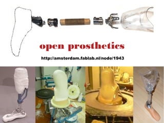 open prosthetics
http://amsterdam.fablab.nl/node/1943
 