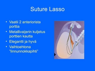 Urheilijan Nillkkavammat Ja Labrum repe m t PPT Urheilijan Nillkkavammat Ja Labrum repe m t PPT