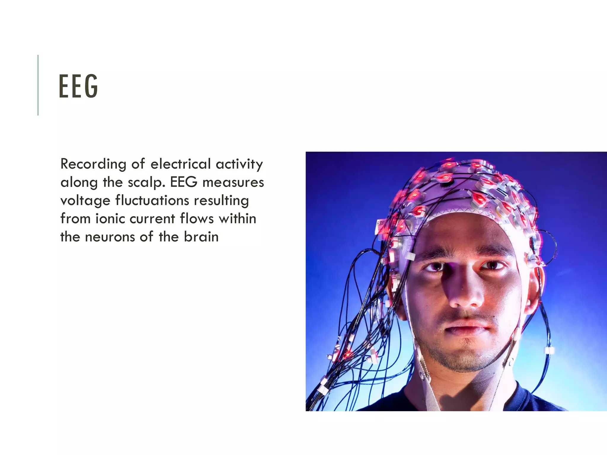EEG
Recording of electrical activity
along the scalp. EEG measures
voltage fluctuations resulting
from ionic current flows within
the neurons of the brain

 