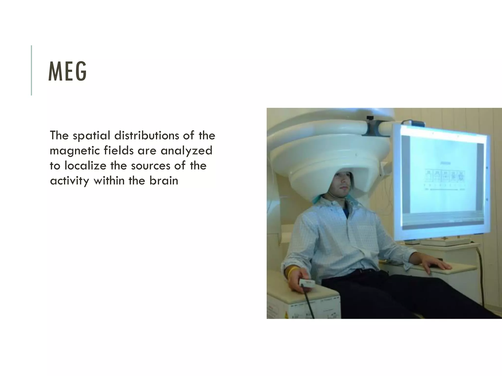 MEG
The spatial distributions of the
magnetic fields are analyzed
to localize the sources of the
activity within the brain

 