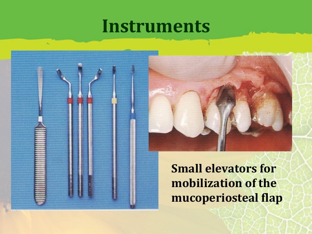 Periodontal Flap Surgery