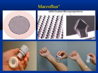 MacrofluxMacroflux®®
 