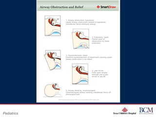 Page 27
Pediatrics   xxx00.#####.ppt 7/10/2012 8:23:12 AM
 