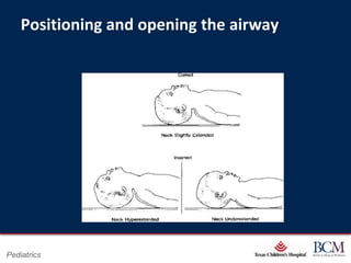 Positioning and opening the airway




                                Page 28
Pediatrics          xxx00.#####.ppt 7/10/2012 8:23:12 AM
 