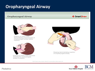 Oropharyngeal Airway




                              Page 31
Pediatrics        xxx00.#####.ppt 7/10/2012 8:23:12 AM
 