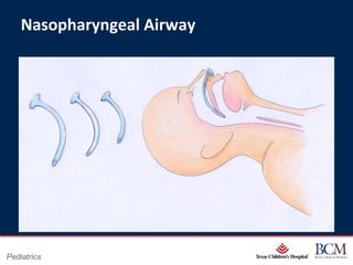 Nasopharyngeal Airway




                              Page 34
Pediatrics        xxx00.#####.ppt 7/10/2012 8:23:12 AM
 