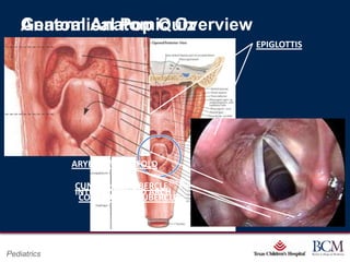 General Anatomic Overview
    Anatomical Pop Quiz
                                                                  EPIGLOTTIS




             ARYEPIGLOTTIC FOLD

             CUNEIFORM TUBERCLE
             INTERARYTENOID ARCH
              CORNICULATE TUBERCLE



                                       Page 42
Pediatrics                 xxx00.#####.ppt 7/10/2012 8:23:12 AM
 