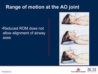 Range of motion at the AO joint



•Reduced ROM does not
 allow alignment of airway
 axes




                                  Page 48
Pediatrics            xxx00.#####.ppt 7/10/2012 8:23:12 AM
 