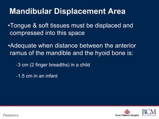 Mandibular Displacement Area
   •Tongue & soft tissues must be displaced and
    compressed into this space

   •Adequate when distance between the anterior
    ramus of the mandible and the hyoid bone is:
        ‐3 cm (2 finger breadths) in a child

        ‐1.5 cm in an infant




                                           Page 49
Pediatrics                     xxx00.#####.ppt 7/10/2012 8:23:12 AM
 