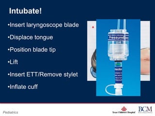 Intubate!
   •Insert laryngoscope blade

   •Displace tongue

   •Position blade tip

   •Lift

   •Insert ETT/Remove stylet

   •Inflate cuff


                                     Page 53
Pediatrics               xxx00.#####.ppt 7/10/2012 8:23:12 AM
 