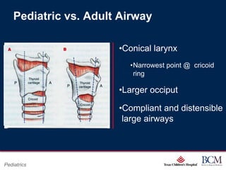 Pediatric vs. Adult Airway

                                        •Conical larynx
                                                •Narrowest point @ cricoid
                                                 ring

                                        •Larger occiput

                                        •Compliant and distensible
                                         large airways



                               Page 6
Pediatrics        xxx00.#####.ppt 7/10/2012 8:23:12 AM
 