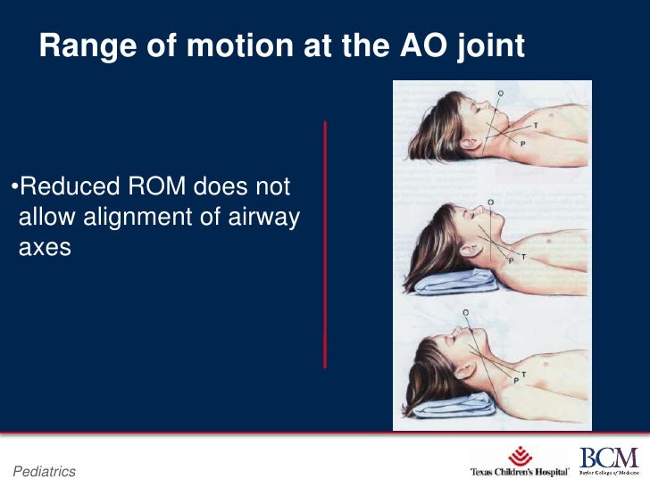 2012 airway management