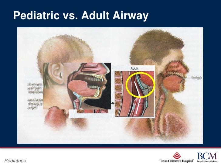 2012 airway management