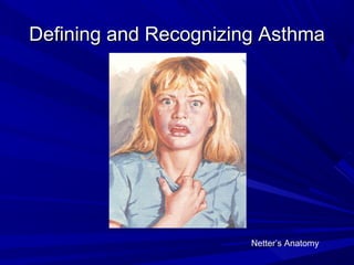 Defining and Recognizing AsthmaDefining and Recognizing Asthma
Netter’s Anatomy
 