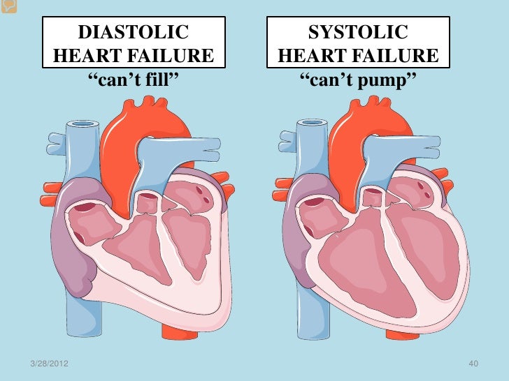 2012 cardiac lecture 2 pathologies