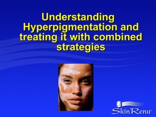 Understanding
 Hyperpigmentation and
treating it with combined
        strategies
 