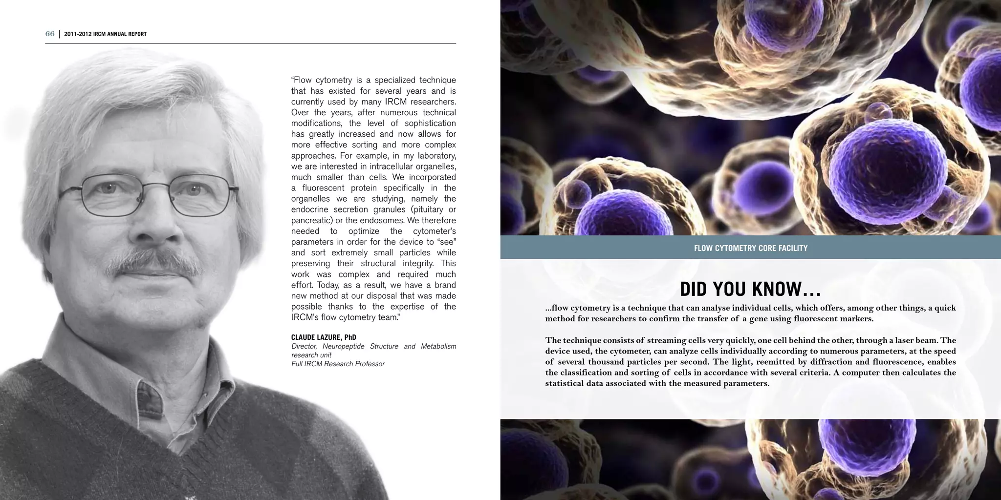 66 | 2011-2012 IRCM ANNUAL REPORT                                                                                                                                                             | 67




                                    “Flow cytometry is a specialized technique
                                    that has existed for several years and is
                                    currently used by many IRCM researchers.
                                    Over the years, after numerous technical
                                    modifications, the level of sophistication
                                    has greatly increased and now allows for
                                    more effective sorting and more complex
                                    approaches. For example, in my laboratory,
                                    we are interested in intracellular organelles,
                                    much smaller than cells. We incorporated
                                    a fluorescent protein specifically in the
                                    organelles we are studying, namely the
                                    endocrine secretion granules (pituitary or
                                    pancreatic) or the endosomes. We therefore
                                    needed to optimize the cytometer’s
                                    parameters in order for the device to “see”
                                                                                                                             FLOW CYTOMETRY CORE FACILITY
                                    and sort extremely small particles while
                                    preserving their structural integrity. This
                                    work was complex and required much
                                    effort. Today, as a result, we have a brand
                                    new method at our disposal that was made                                             DID YOU KNOW…
                                    possible thanks to the expertise of the           ...flow cytometry is a technique that can analyse individual cells, which offers, among other things, a quick
                                    IRCM’s flow cytometry team.”                      method for researchers to confirm the transfer of a gene using fluorescent markers.

                                    CLAUDE LAZURE, Phd                                The technique consists of streaming cells very quickly, one cell behind the other, through a laser beam. The
                                    Director, Neuropeptide Structure and Metabolism
                                    research unit                                     device used, the cytometer, can analyze cells individually according to numerous parameters, at the speed
                                    Full IRCM Research Professor                      of several thousand particles per second. The light, reemitted by diffraction and fluorescence, enables
                                                                                      the classification and sorting of cells in accordance with several criteria. A computer then calculates the
                                                                                      statistical data associated with the measured parameters.
 