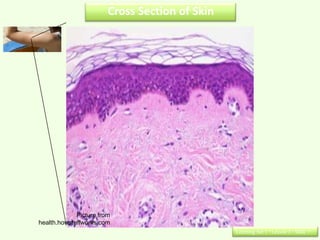 Cross Section of Skin

                               Top layer




             Picture from
health.howstuffworks.com
                                                Learning Set 1 : Lesson 3 : Slide 7
 