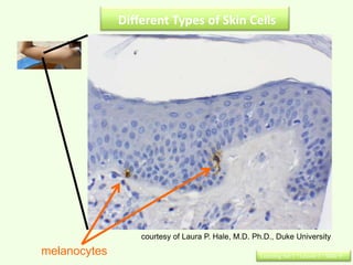 Different Types of Skin Cells




                  courtesy of Laura P. Hale, M.D. Ph.D., Duke University
melanocytes                                        Learning Set 1 : Lesson 3 : Slide 9
 