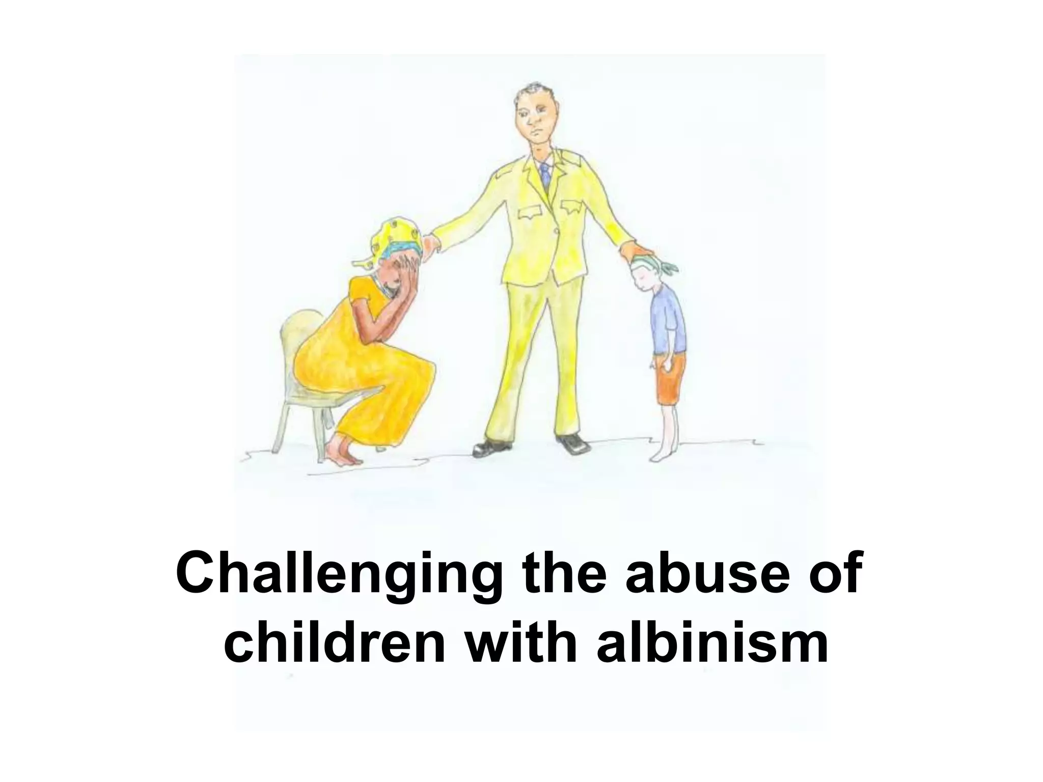 Challenging the abuse of
 children with albinism
 